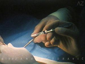 Anastomosis-2©1982-AZdravic 300